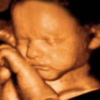 Prenatal Tanının Geleceği Maternal Kanda Fetal DNA Tayini ve Olası Tehlikeler